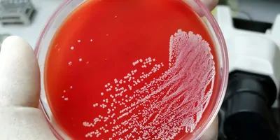A gloved hand holds a Petriplate with bacterial colonies growing 
