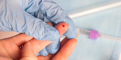 Close-up of blood sampling from a finger prick.