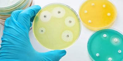 Antimicrobial test in a petri dish