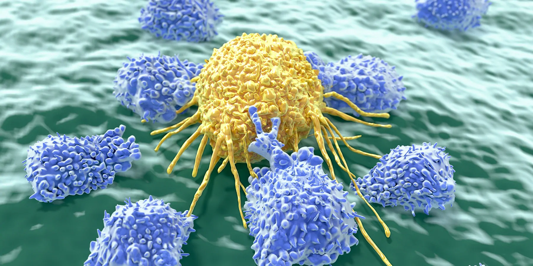 Natural killer cells are a type of lymphocytes that destroy cancer cells and other altered cells releasing cytotoxic granules.