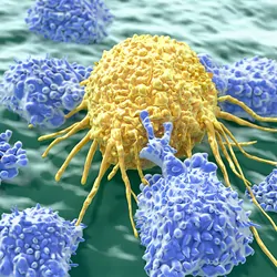 Natural killer cells are a type of lymphocytes that destroy cancer cells and other altered cells releasing cytotoxic granules.