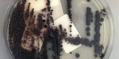 Clostridioides difficile infections are considered the leading cause of infectious healthcare-related diarrhea worldwide and substantial costs have been attributed to its management.