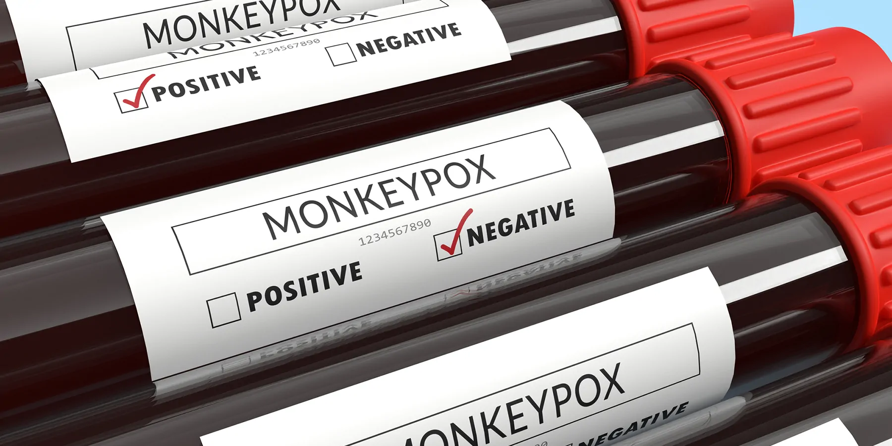 Monkeypox negative result area checked with red highlighter on blood test tubes on blue background.