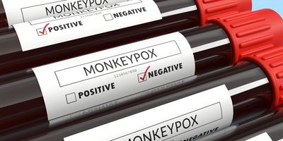 Monkeypox negative result area checked with red highlighter on blood test tubes on blue background.