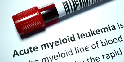 Blood vacutainer labeled Acute myeloid leukemia against a disease report in the background.