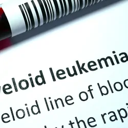 Blood vacutainer labeled Acute myeloid leukemia against a disease report in the background.