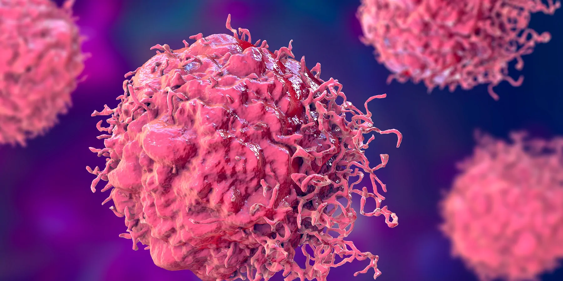 3D illustration of cancer cells, malignant cells