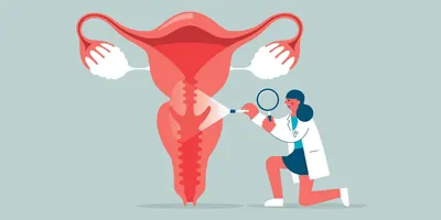 Illustration depicting a health care professional examining the uterus for signs of cervical cancer