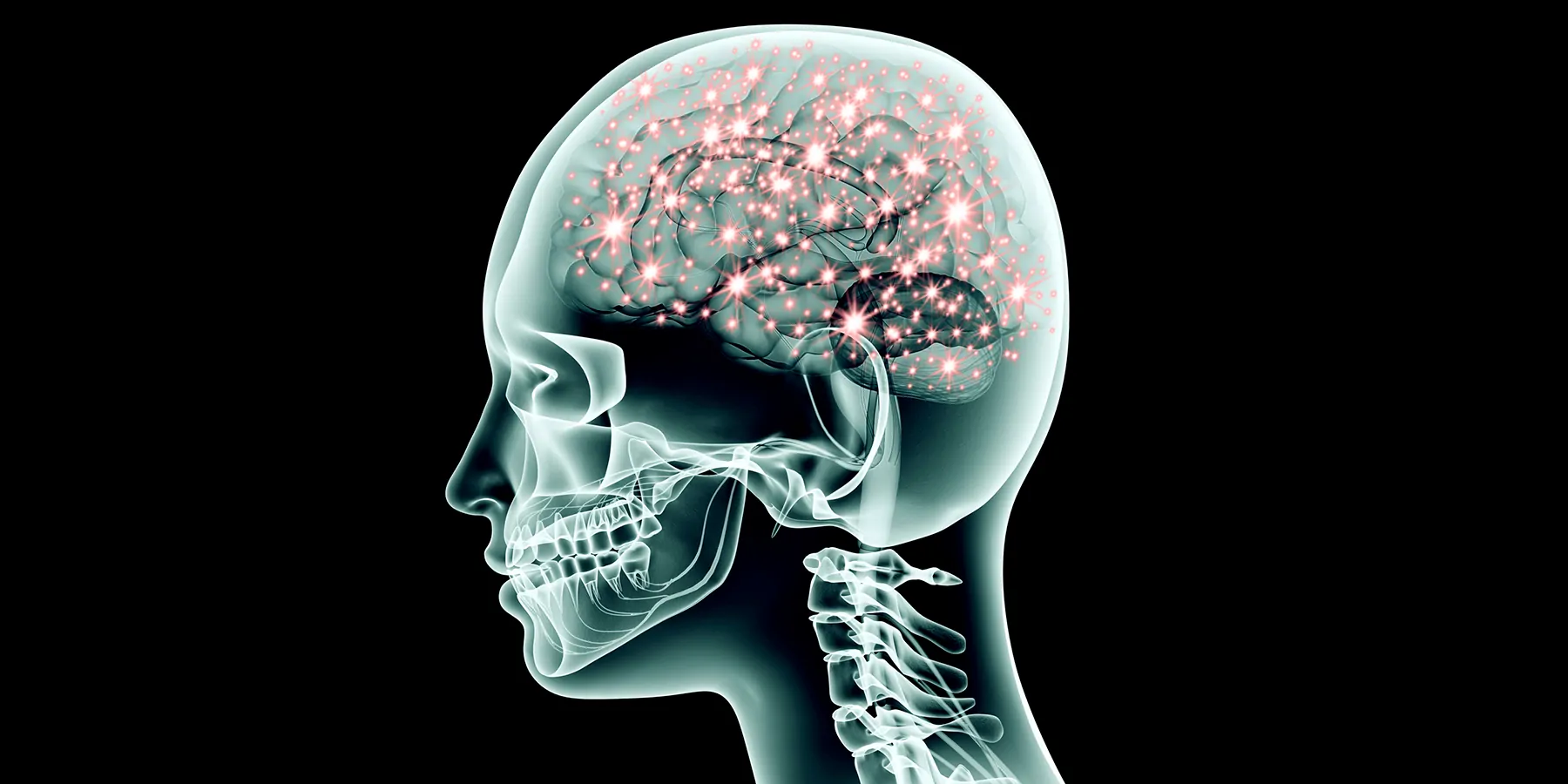 3D illustration of an X-ray of human brain showing electric pulses