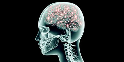 3D illustration of an X-ray of human brain showing electric pulses