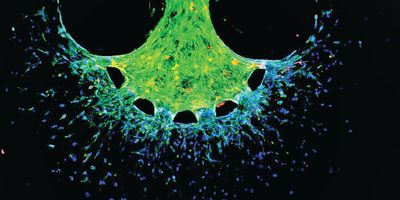 Z-projection of cytoskeletal staining of invading cancer cells within the tumor-on-chip model (F-actin = green, DAPI = blue).