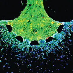 Z-projection of cytoskeletal staining of invading cancer cells within the tumor-on-chip model (F-actin = green, DAPI = blue).