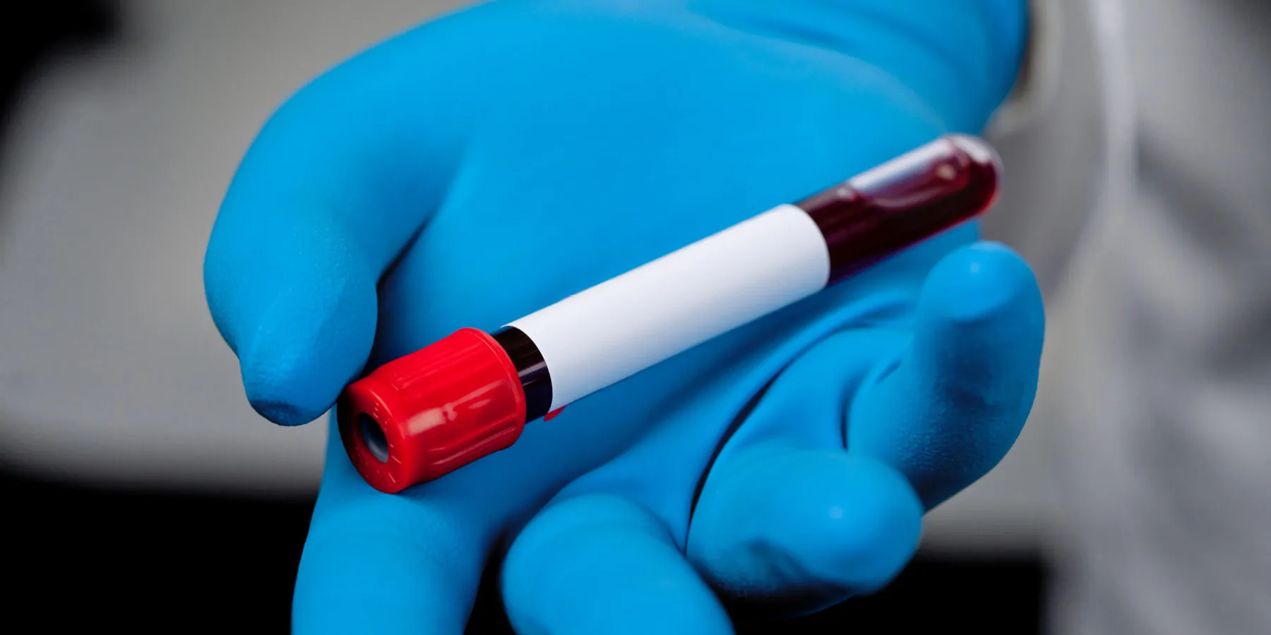 A gloved hand holds an unlabelled vacutainer with blood sample 