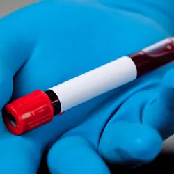 A gloved hand holds an unlabelled vacutainer with blood sample 