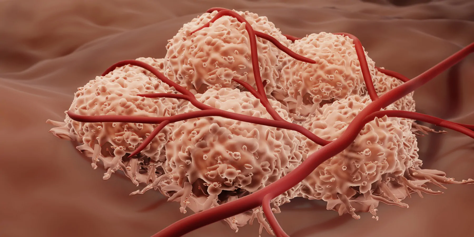 Illustration showing blood supply to cancer cells or angiogenesis.
