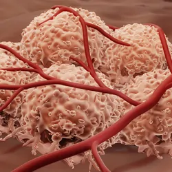 Illustration showing blood supply to cancer cells or angiogenesis.