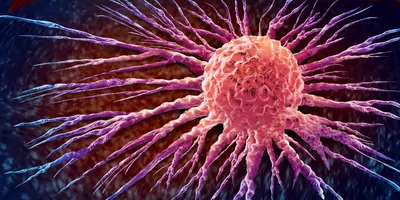 3D illustration of a Malignant cancerous cell with vasculature