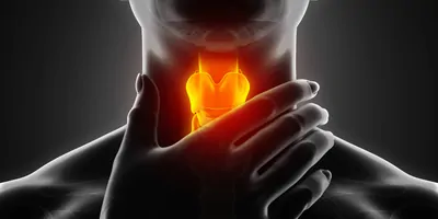 3D illustration of sore throat, cancer of pharynx