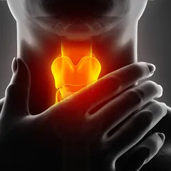 3D illustration of sore throat, cancer of pharynx