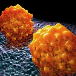 3D illustration of tumor cells