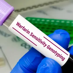 Warfarin Sensitivity Genotyping in a clinical research laboratory to diagnose the tolerance of the drug warfarin.