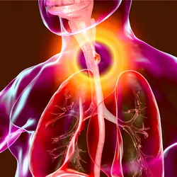 3D illustration showing a malignant tumor in the human esophagus