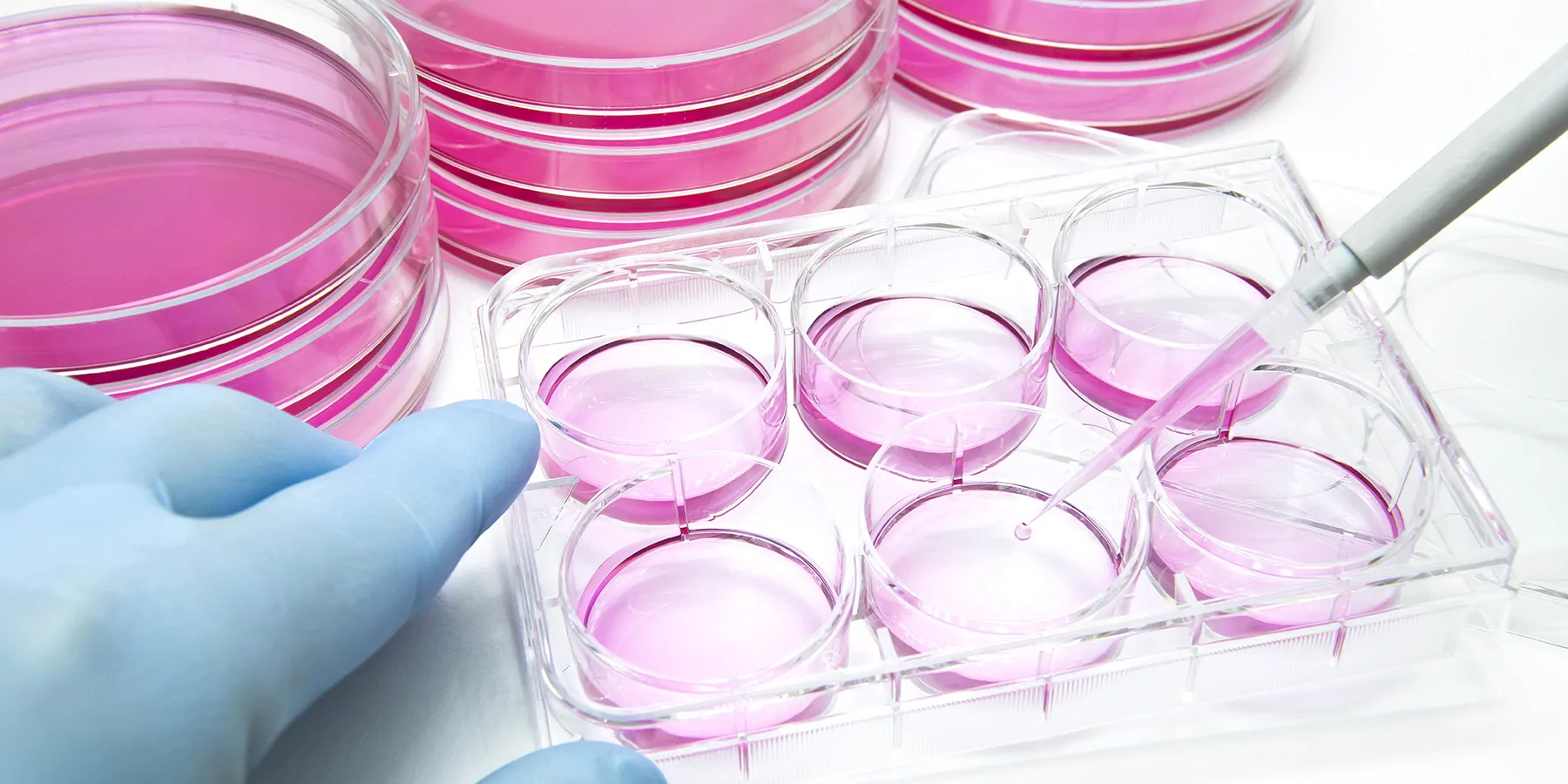 istock-1181981719-1800x900 A researcher wearing blue gloves pipettes pink liquid into a 6-well plastic plate. A stack of petri dishes of pink agarose are stacked behind them.