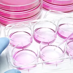 A researcher wearing blue gloves pipettes pink liquid into a 6-well plastic plate. A stack of petri dishes of pink agarose are stacked behind them.