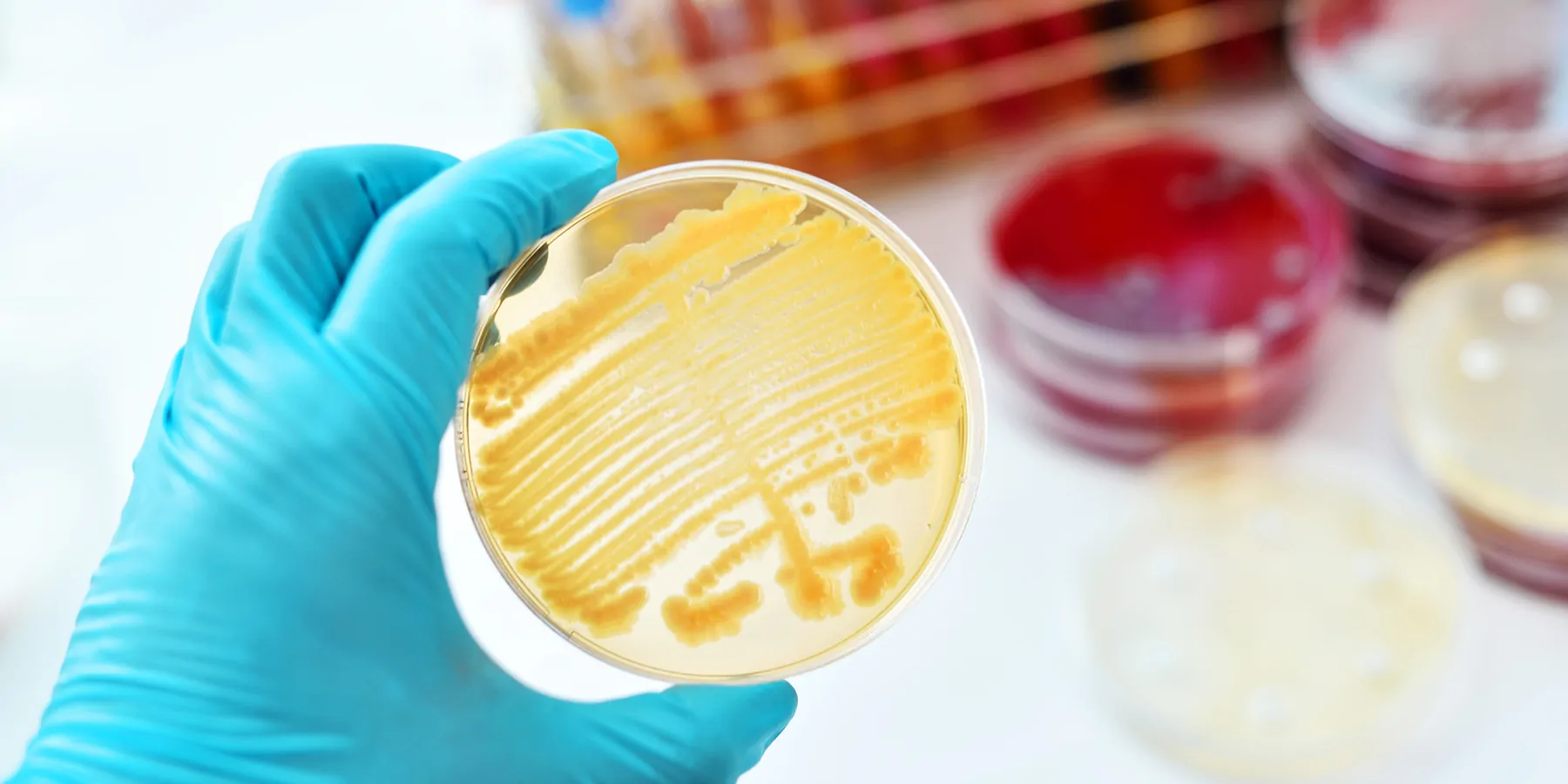 A gloved hand shows colonies of bacteria in petri dish