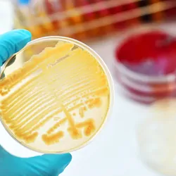 A gloved hand shows colonies of bacteria in petri dish
