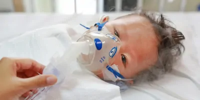 A sick baby boy in a crib wears an inhalation mask with medication to cure Respiratory Syncytial Virus (RSV) at the hospital.