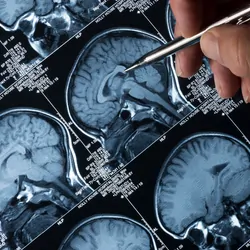 MRI brain scan of head and skull with hand pointing