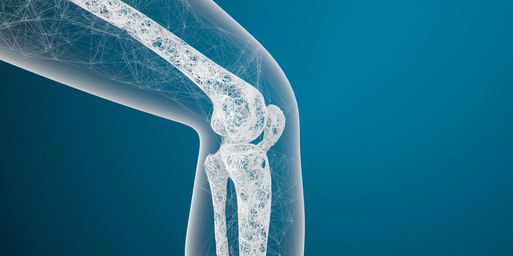 3D rendering of a scanned image of a human knee joint and bones
