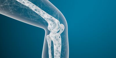 3D rendering of a scanned image of a human knee joint and bones