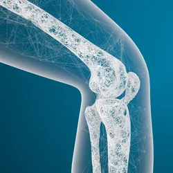 3D rendering of a scanned image of a human knee joint and bones