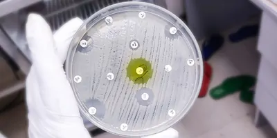 Antimicrobial susceptibility testing in culture plate