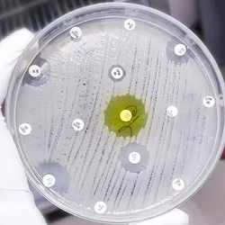 Antimicrobial susceptibility testing in culture plate