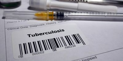 Tuberculosis test requisition with a syringe in the background.