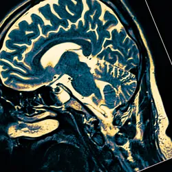 MRI scan of a human brain.