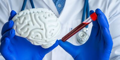 A laboratory technician holds in one hand a test tube with blood and figure of brain in the other