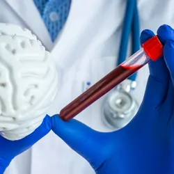 A laboratory technician holds in one hand a test tube with blood and figure of brain in the other