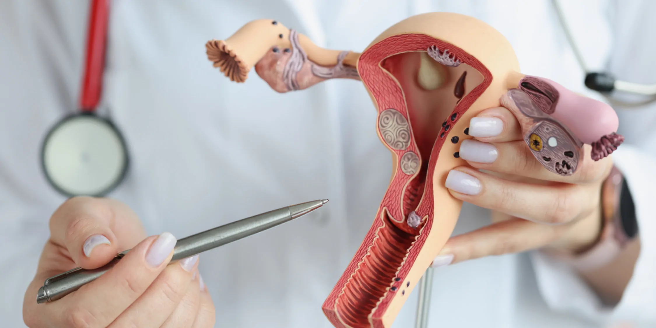 A clinician holds a sectional model of the female reproductive organs, close-up.