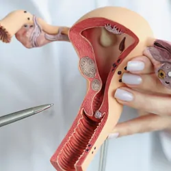 A clinician holds a sectional model of the female reproductive organs, close-up.