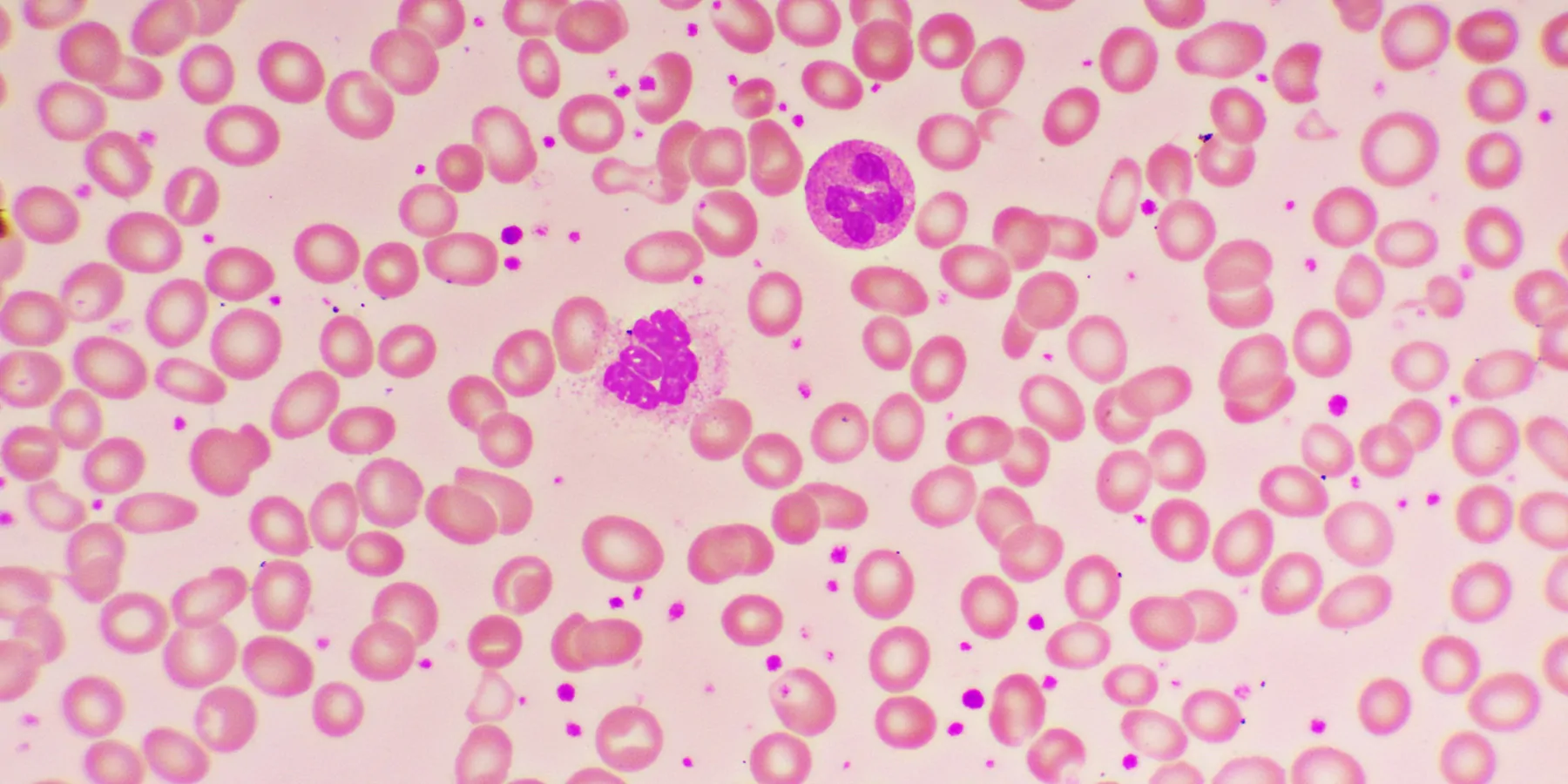 3D illustration showing abundant red and white blood cells inside a blood vessel