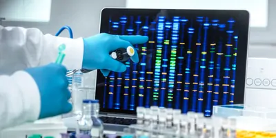 A researcher points to glowing DNA electrophoresis results from samples in the lab.