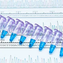 PCR tubes placed by DNA analysis chromatogram with peaks and base counts.