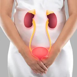 Illustration of the bladder and kidneys on the woman's body. 