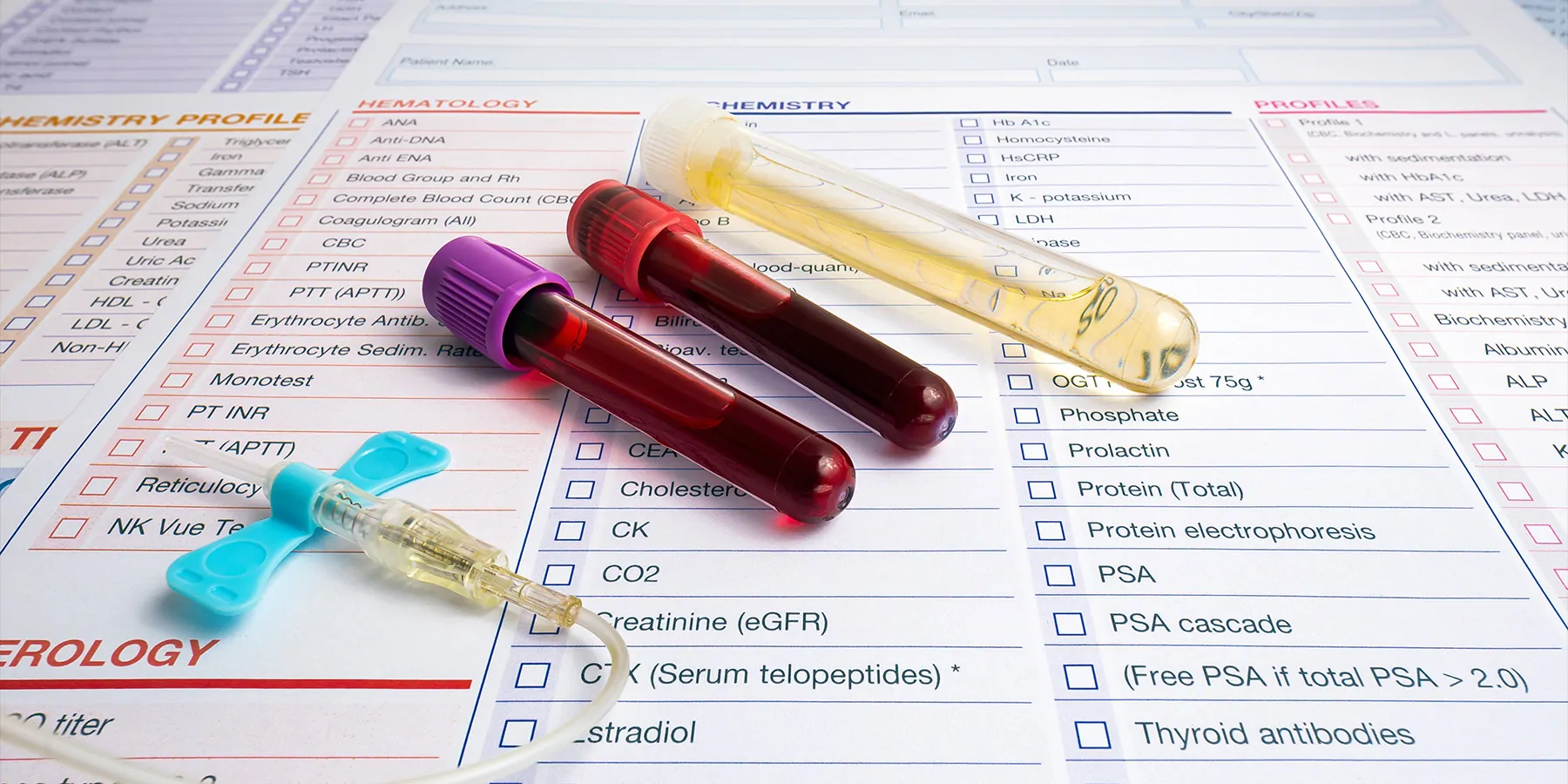 Novel Biomarkers Predict Heart and Kidney Disease in People with T2D A gloved hand holds a blood-containing vacutainer against a background of test tubes in a stand.