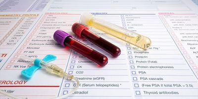 A gloved hand holds a blood-containing vacutainer against a background of test tubes in a stand.