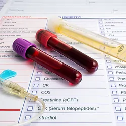A gloved hand holds a blood-containing vacutainer against a background of test tubes in a stand.